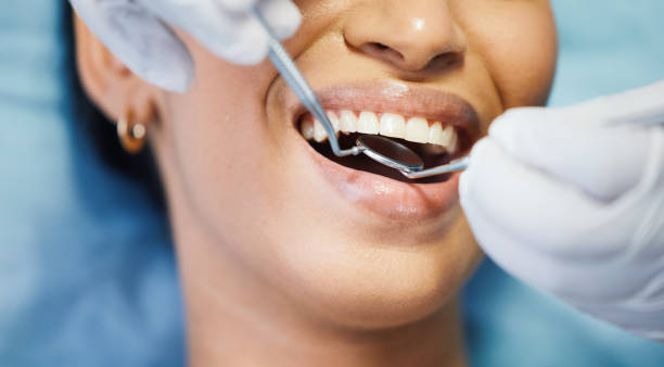 Best Chipped Tooth Repair Near Me  in Lincoln University, PA